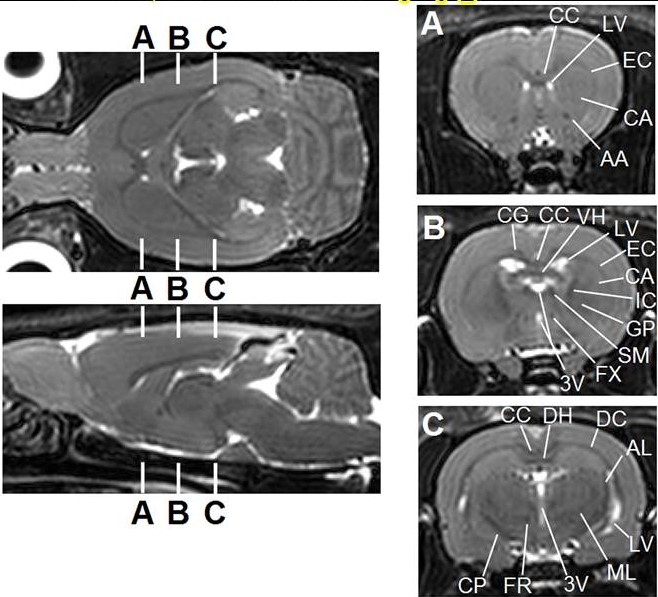 Rat Brain.