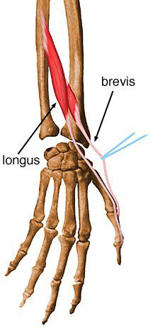 Extensor pollicis brevis.